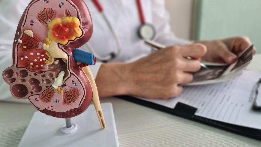 Doppio trapianto di rene a Novara